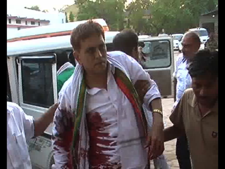 One of the injured victims after the Maoist ambush in Chhattisgarh on Saturday evening.